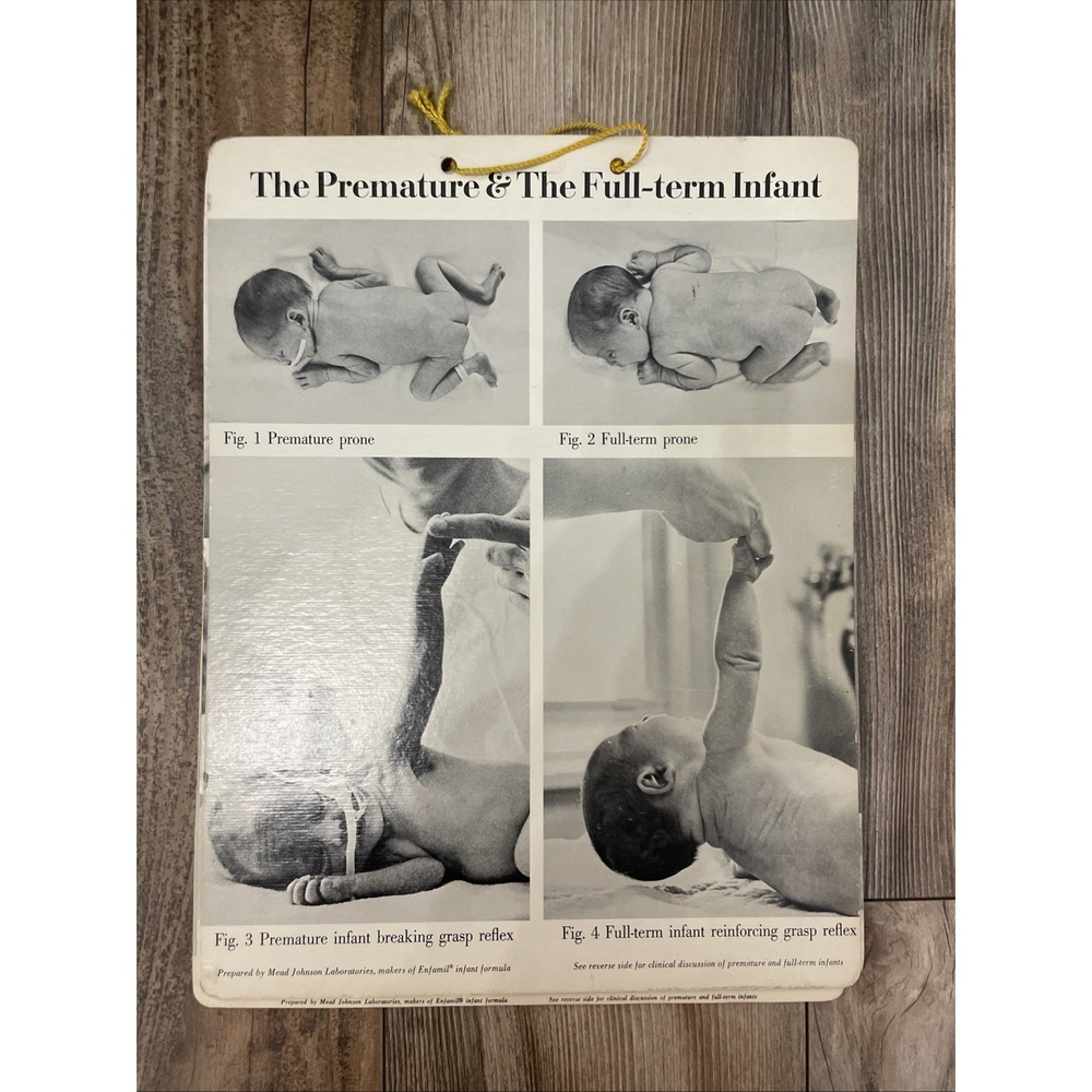 Mead Johnson VTG 1968 Medical Posters 12x15 Newborn Reflex Muscle Tone Lot Of 3